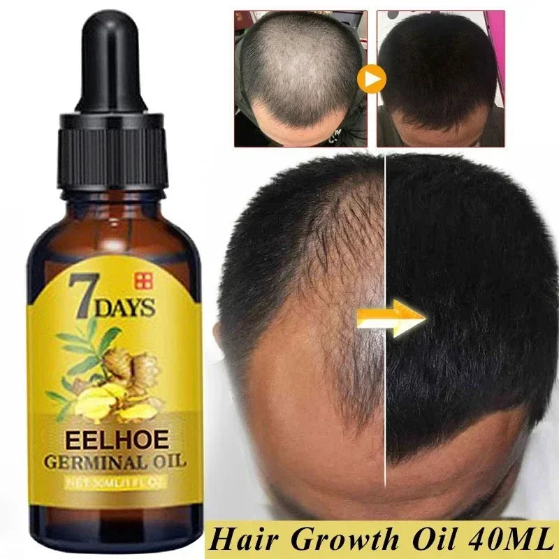 10/20/40ml Hair Care Hair Growth Essential Oils Essence Authentic Hair Loss Liquid Health Care Beauty Dense Hairs Growth Serum